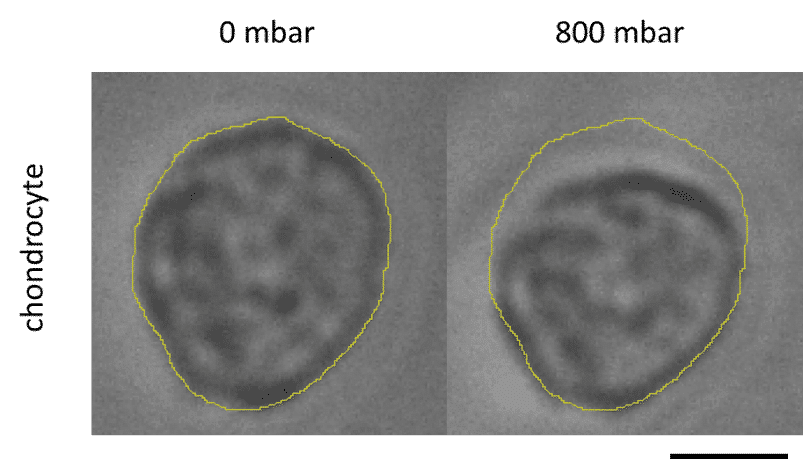 Chondrocyte deformation
