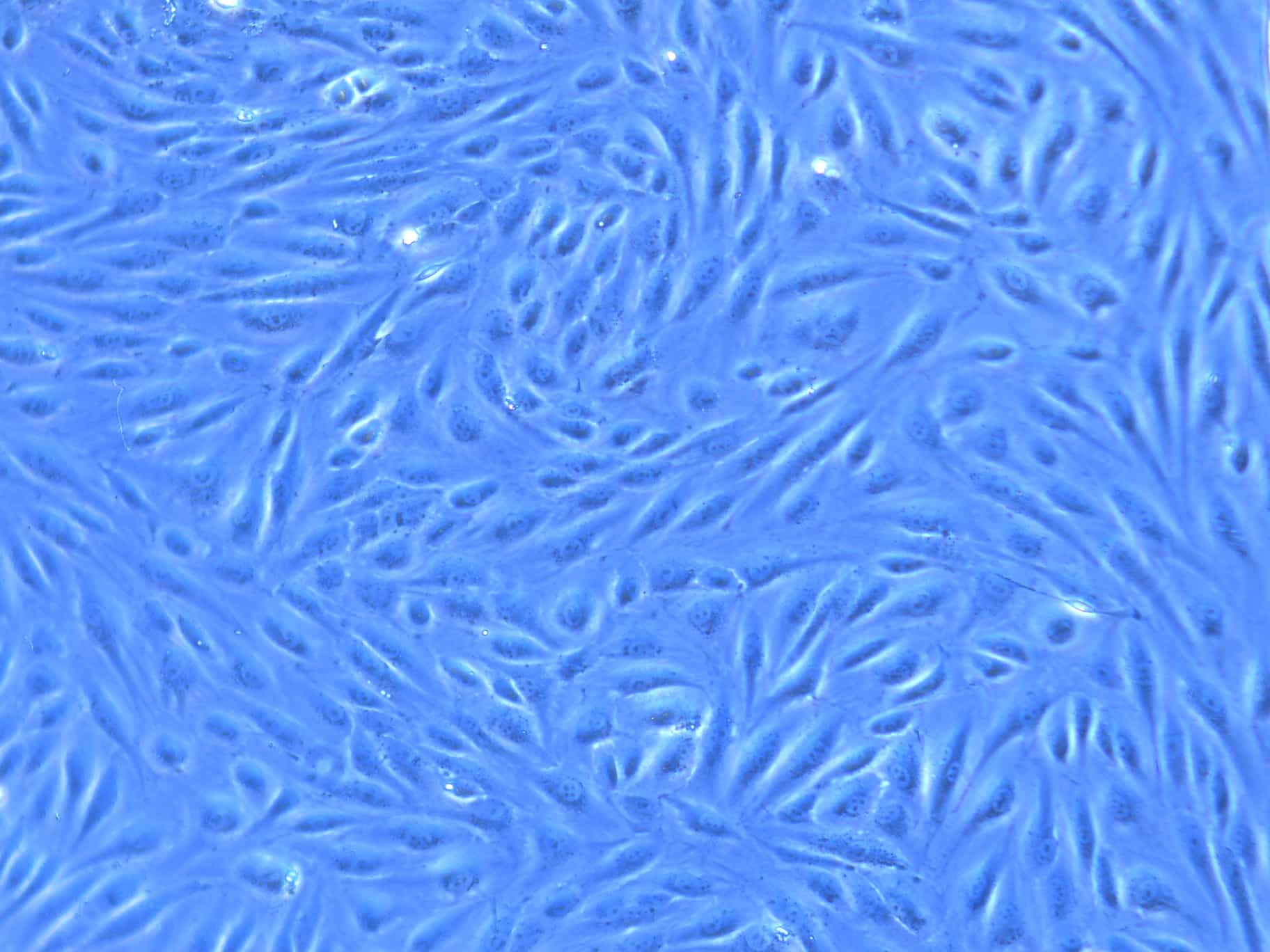 HUVEC after 7 days of culture media recirculation with Omi